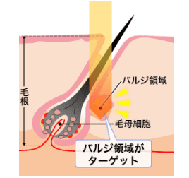 蓄熱式の画像