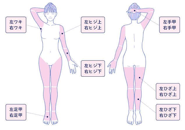 ジュニアプランの照射範囲の画像
